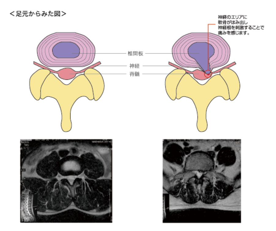 横断面